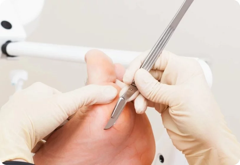 Wzmożona profilaktyka dla osób z cukrzycą