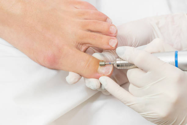 Skrócenie, oczyszczenie i opracowanie paznokci