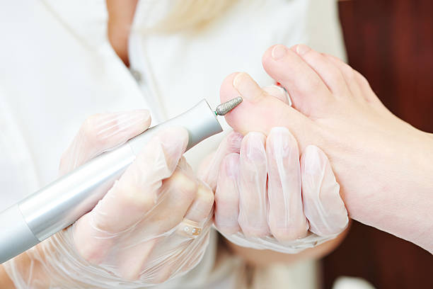 Oczyszczenie paznokci uszkodzonych/przerośniętych/ zmienionych chorobowo (grzybica, zielona bakteria, łuszczyca